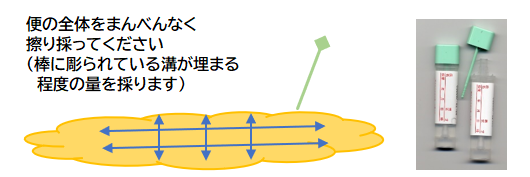 大腸がん検診採便方法